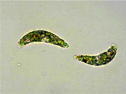 Augentierchen (Euglena spec.)