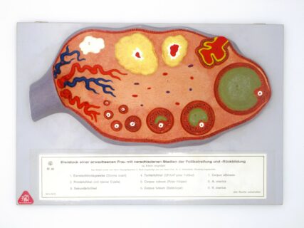 Eierstock einer Frau mit verschiedenen Stadien der Follikelreifung und – Rückbildung© Original SOMSO®Modell